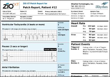 zio heart monitor results